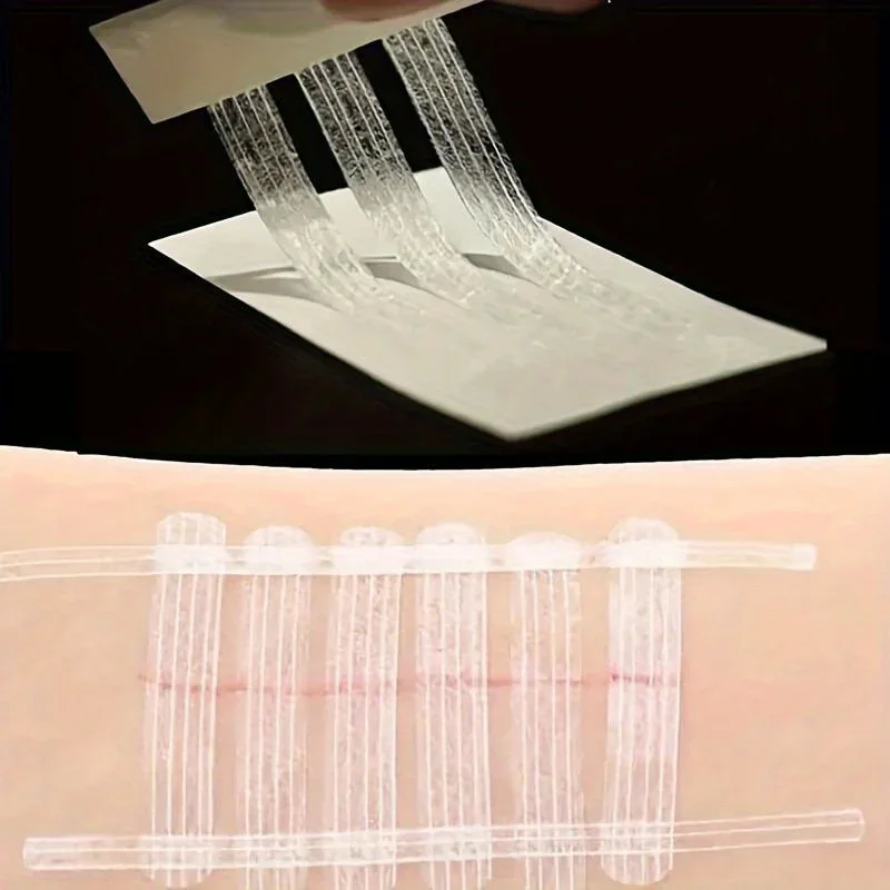 5 Strips Wound Skin Closure St - Medical Label review and price