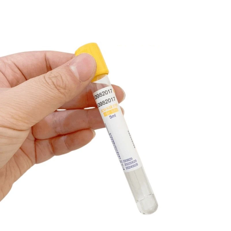 Disposable Vacuum Blood Collec - Medical Lab Blood Test review and price